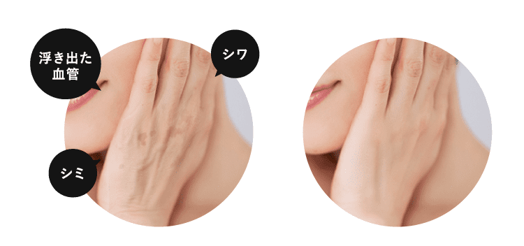 老け手の若見え手の比較